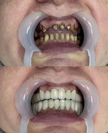 2dbe44e9-dd68-425f-94ee-c07d725dff05-зубы5.jpg